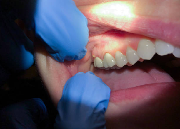 Best Affordable Emergency Dental Care  in Marshall, TX
